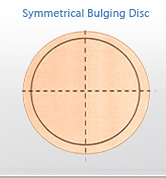 bulging disc 1