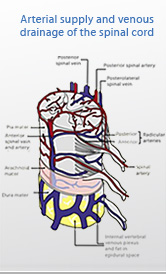 herniated disc 2