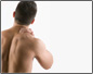 herniated disc 5